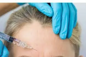 Neuromoduladores: el pequeño gesto que devuelve frescura al rostro